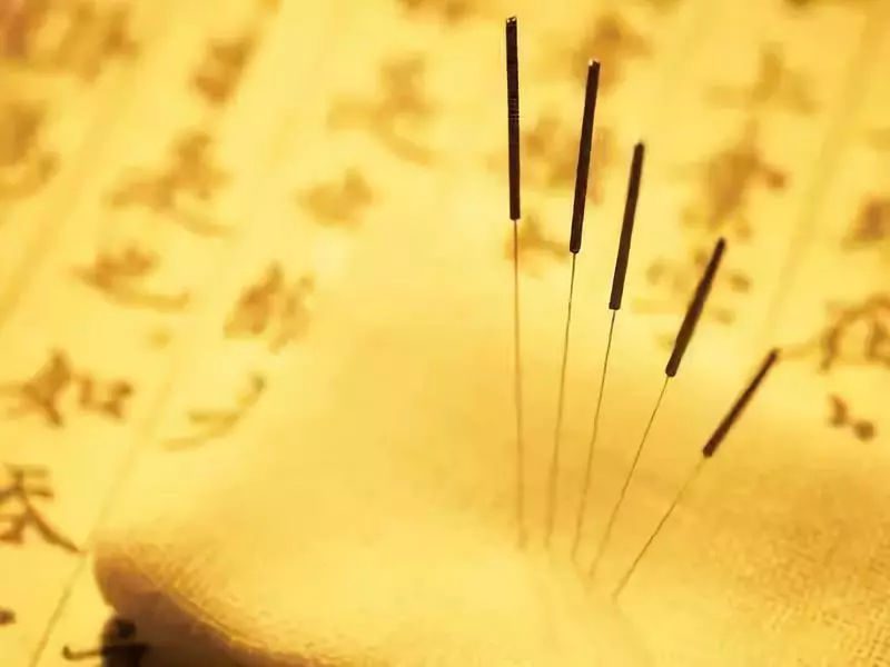 Chinese acupuncture TCM wellness china secret
